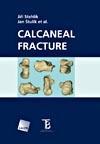 Calcaneal fracture