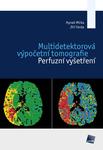 Multidetektorová výpočetní tomografie. Perfuzní vyšetření