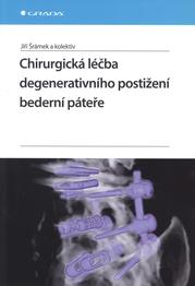 Chirurgická léčba degenerativního postižení bederní páteře