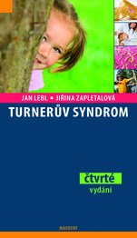 Turnerův syndrom