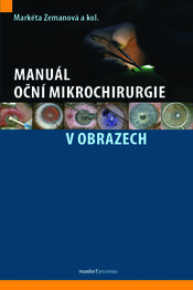 Manuál oční mikrochirurgie v obrazech