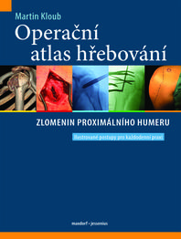 Operační atlas hřebování zlomenin proximálního humeru