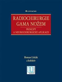 Radiochirurgie GAMA nožem